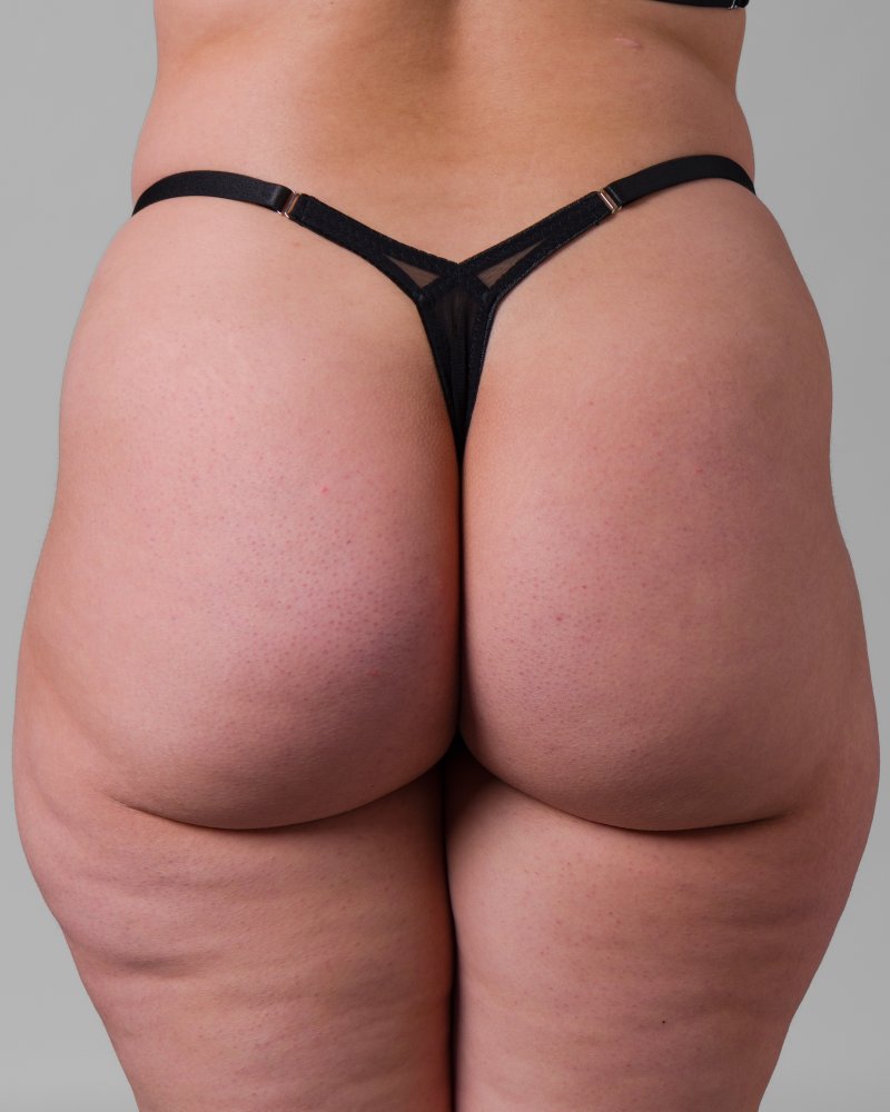 Overlay Thong